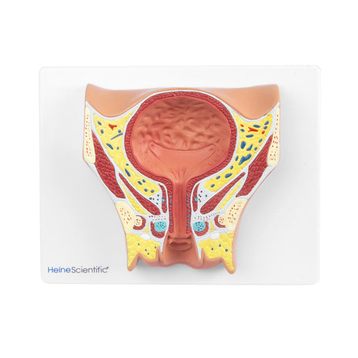 HeineScientific Female Bladder Model with Base