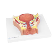 HeineScientific Female Bladder Model with Base