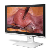 BenQ SE26101 26-Inch Full-HD Surgical Monitor