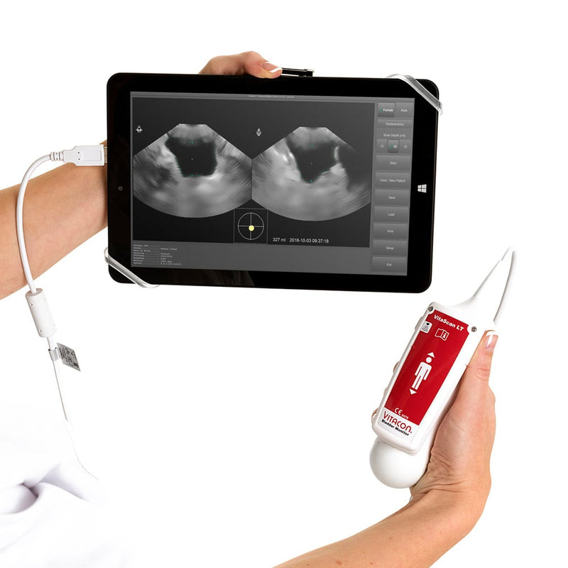 VITACON VitaScan v.2 Bladder Scanner