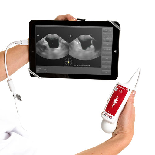 VITACON VitaScan v.2 Bladder Scanner