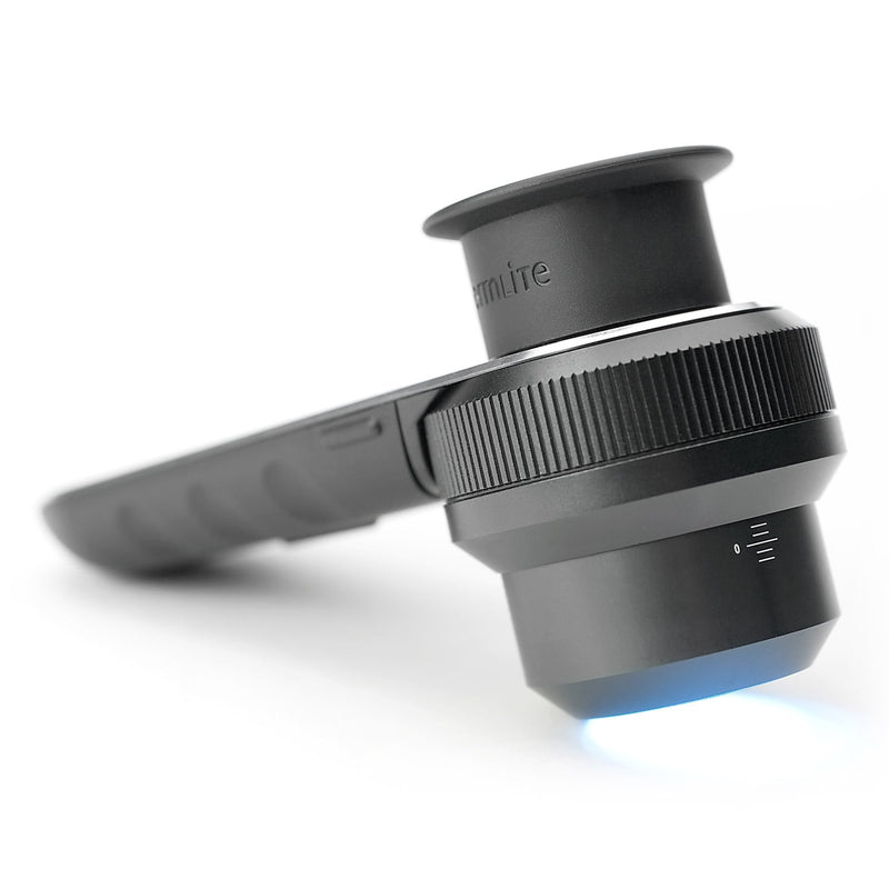 DermLite DL3N Polarised Light Dermatoscope
