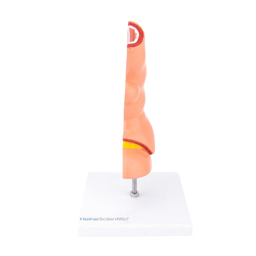 HeineScientific Oesophagus Model with Diseases
