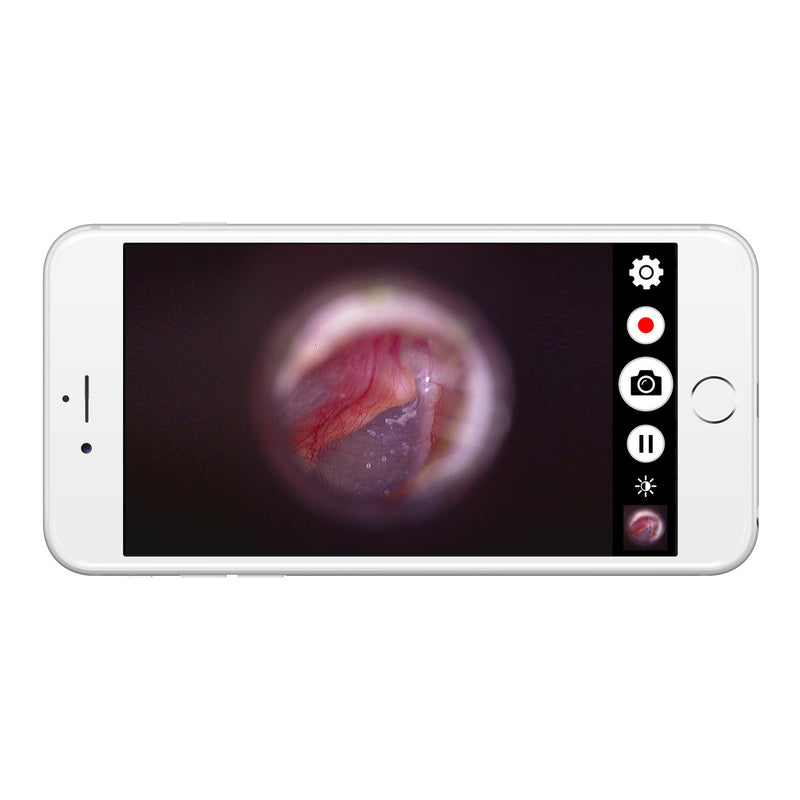 Firefly DE570 W-LAN HD Digital Otoscope