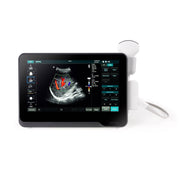 BenQ T3300 Portable Ultrasound System