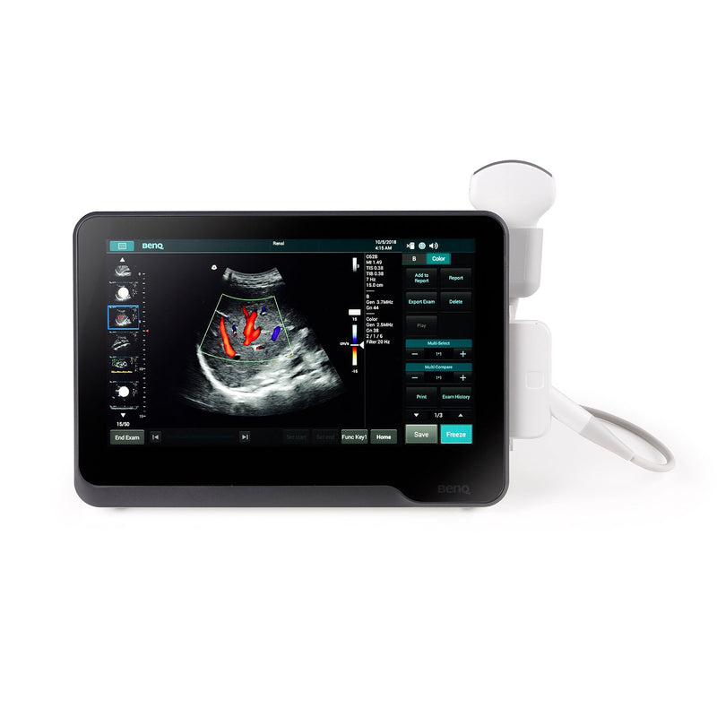 BenQ T3300 Portable Ultrasound System