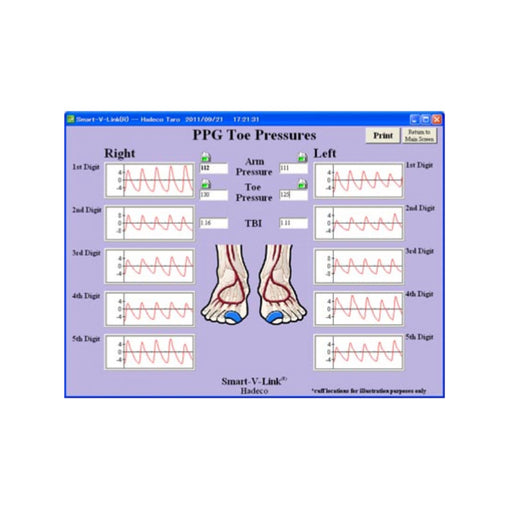 Smart-V-Link Software for Doppler Data Analysis