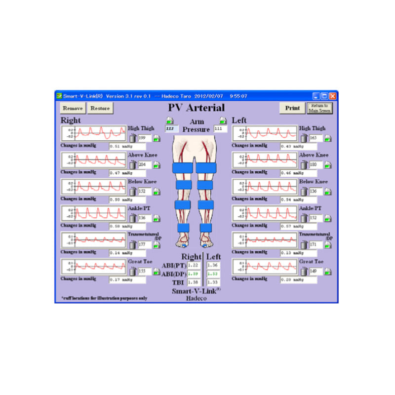 Smart-V-Link Software for Doppler Data Analysis