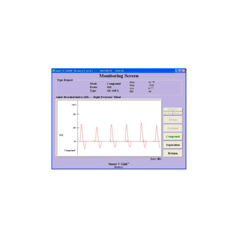 Smart-V-Link Software for Doppler Data Analysis