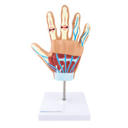 HeineScientific Anatomical Hand Model with Rheumatoid Arthritis