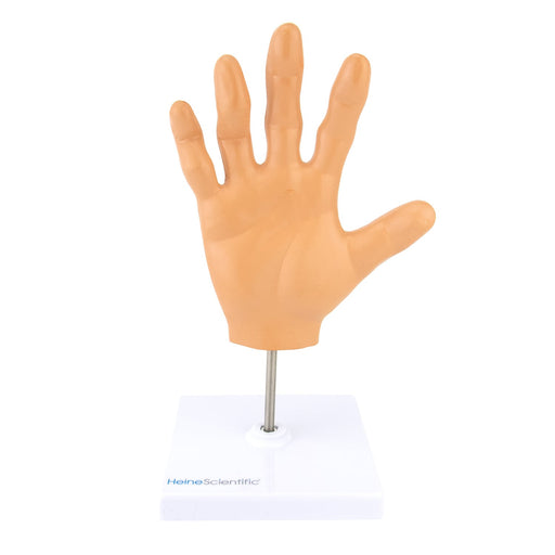 HeineScientific Anatomical Hand Model with Rheumatoid Arthritis