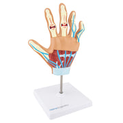 HeineScientific Anatomical Hand Model with Rheumatoid Arthritis