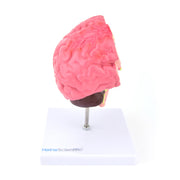 HeineScientific Brain Model with Diseases