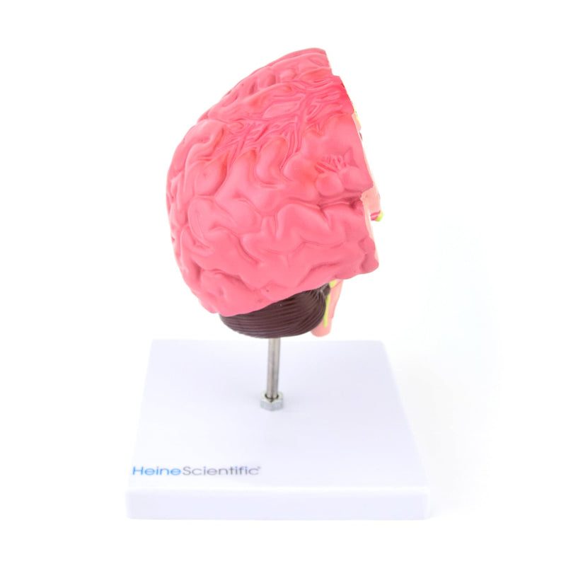 HeineScientific Brain Model with Diseases