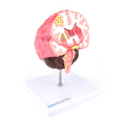 HeineScientific Brain Model with Diseases