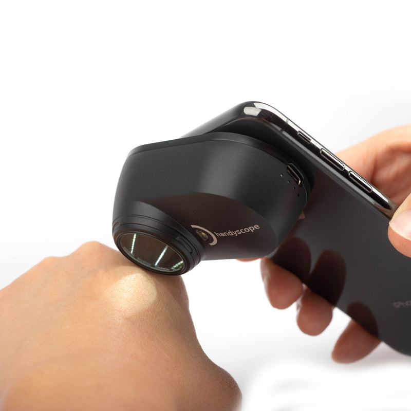 DermLite Handyscope Dermatoscope