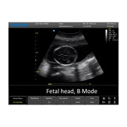 Chison ECO 6 Ultrasound Machine with Colour Doppler