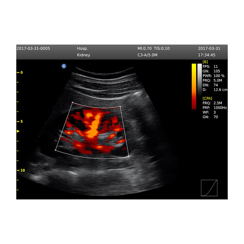Chison ECO 6 Ultrasound Machine with Colour Doppler
