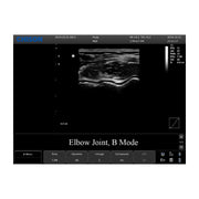 Chison ECO 1 Portable Ultrasound Machine