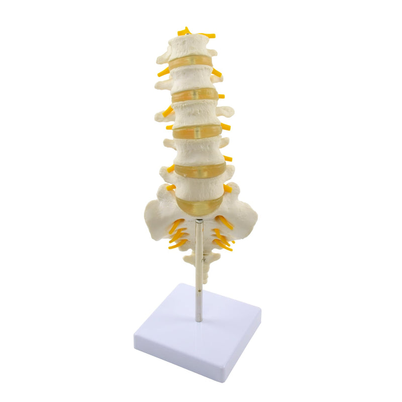 HeineScientific Lumbar Spine Anatomical Model Life-Size