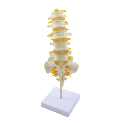 HeineScientific Lumbar Spine Anatomical Model Life-Size