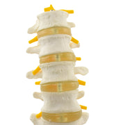 HeineScientific Lumbar Spine Anatomical Model Life-Size