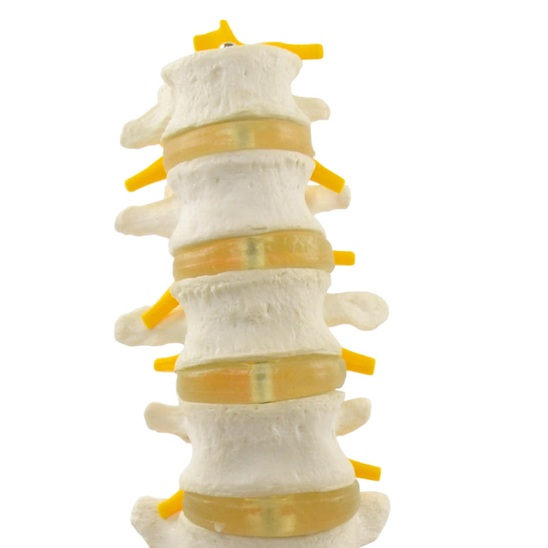HeineScientific Lumbar Spine Anatomical Model Life-Size