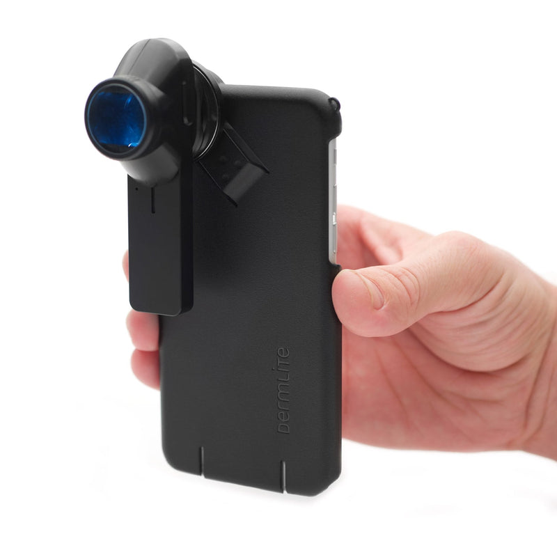 DermLite DL1 Basic Dermatoscope
