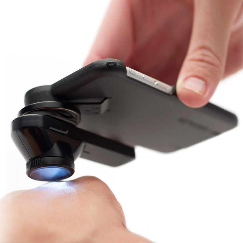 DermLite DL1 Basic Dermatoscope
