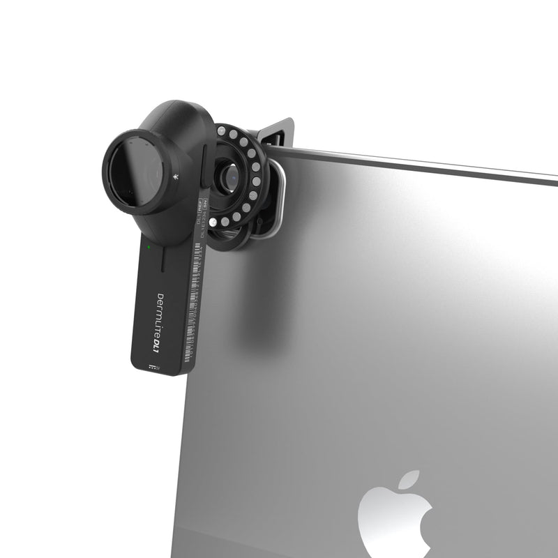 DermLite DL1 Basic Dermatoscope