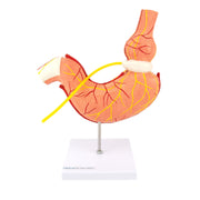 HeineScientific Stomach Model with Gastric Band