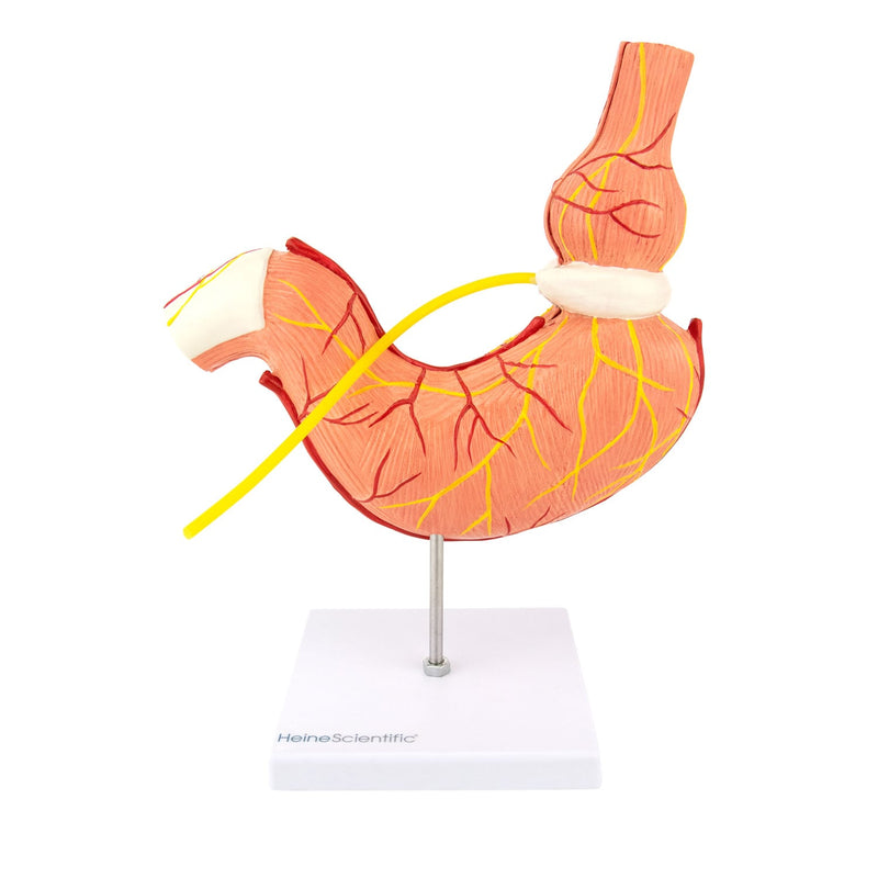 HeineScientific Stomach Model with Gastric Band
