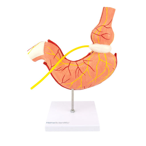 HeineScientific Stomach Model with Gastric Band