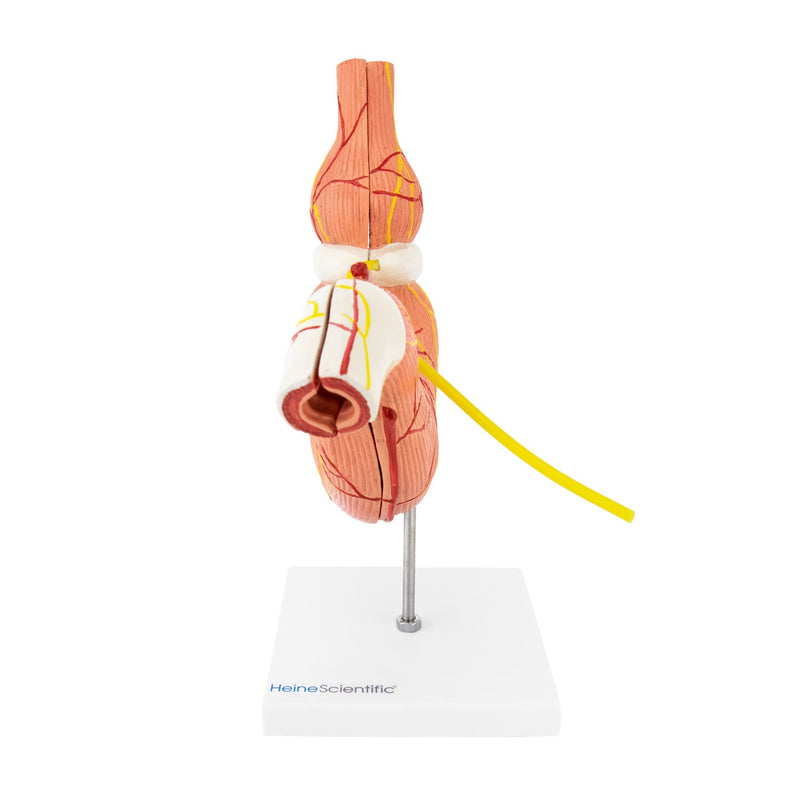 HeineScientific Stomach Model with Gastric Band