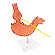 HeineScientific Stomach Model with Gastric Band