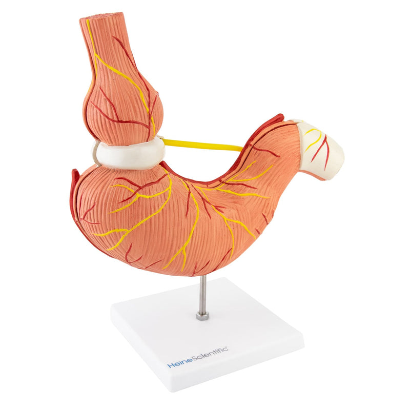 HeineScientific Stomach Model with Gastric Band