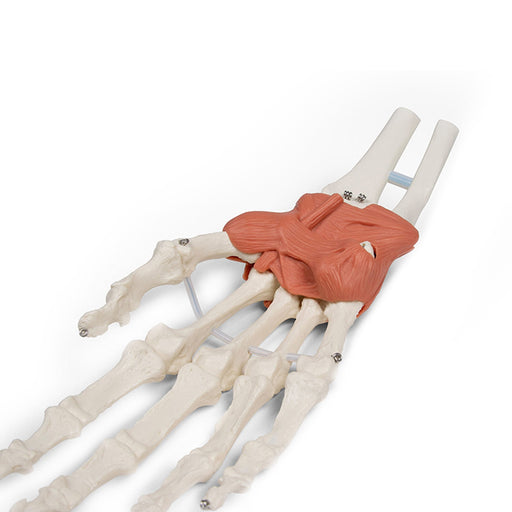 Erler-Zimmer Wrist Ligaments Model Life-Size
