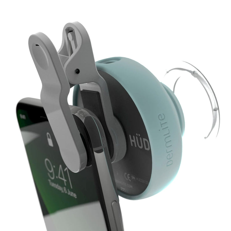 DermLite HÜD2 Smartphone Dermatoscope