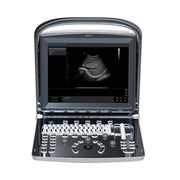 Chison ECO 1 Portable Ultrasound Machine