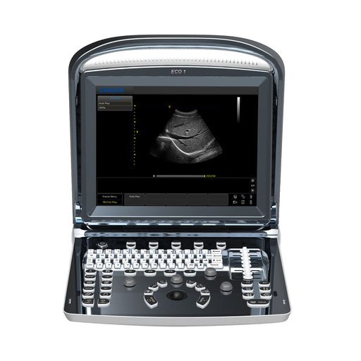 Chison ECO 1 Portable Ultrasound Machine