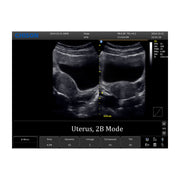 Chison ECO 1 Portable Ultrasound Machine