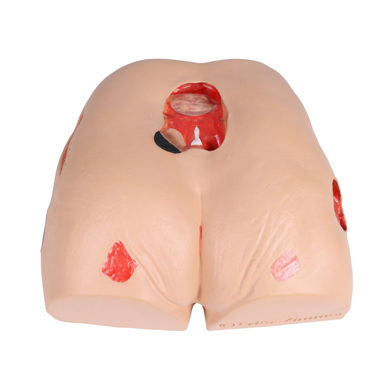 Erler-Zimmer DECUBITUS DAN Treatment Simulator