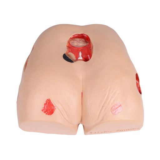 Erler-Zimmer DECUBITUS DAN Treatment Simulator