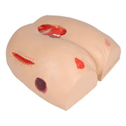 Erler-Zimmer DECUBITUS DAN Treatment Simulator