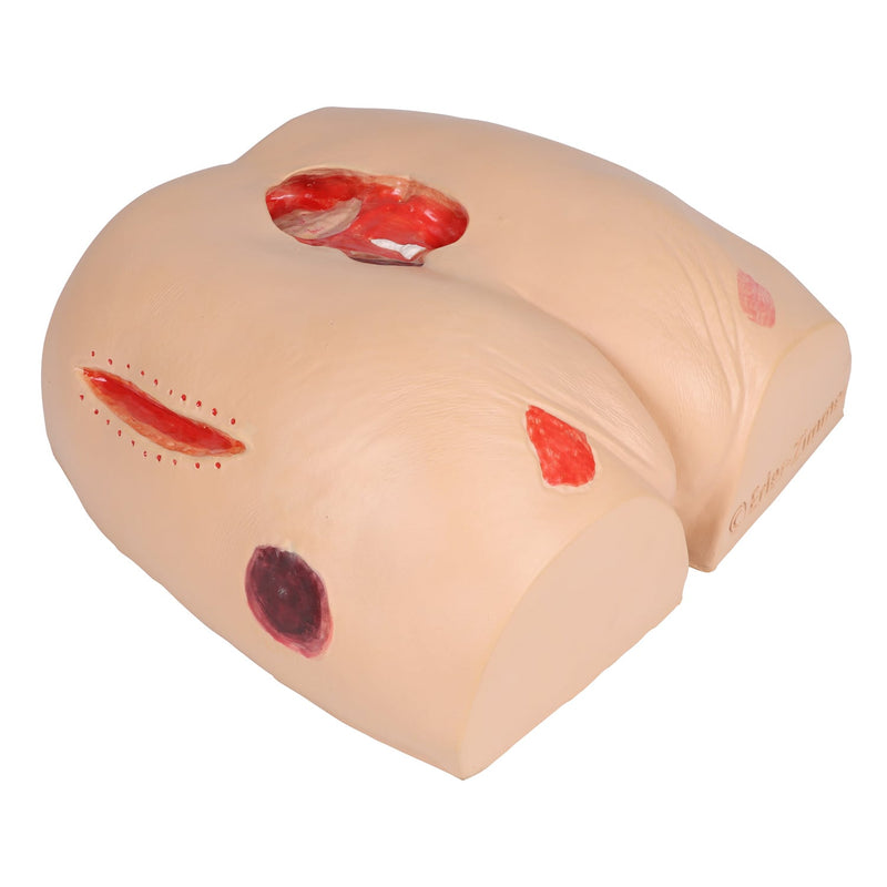Erler-Zimmer DECUBITUS DAN Treatment Simulator