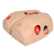 Erler-Zimmer DECUBITUS DAN Treatment Simulator