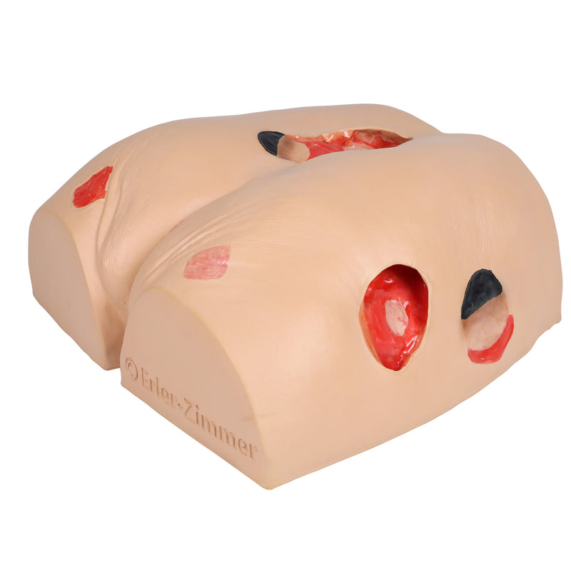 Erler-Zimmer DECUBITUS DAN Treatment Simulator