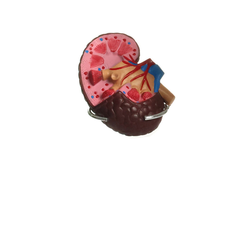HeineScientific Hypertension Model Set 6-Part Anatomical Model