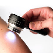 DermLite DL4W Dermatoscope with White Light
