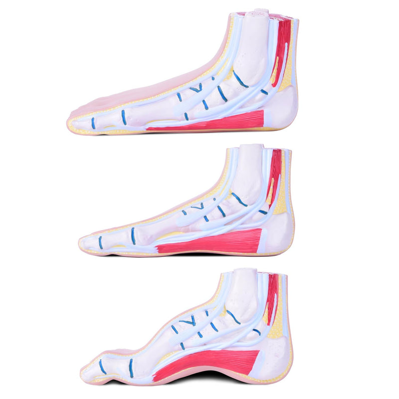 HeineScientific Foot Malpositions Anatomical Model Set